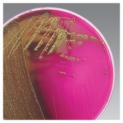 m-endo agar